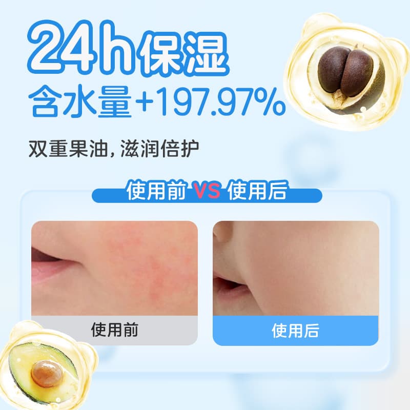 Little Raccoon Moisturizing Cream Children's Winter Skin Care Baby Face Cream Chapped Moisturizing Cream Free Lipstick Children's Face Cream Lotion 4