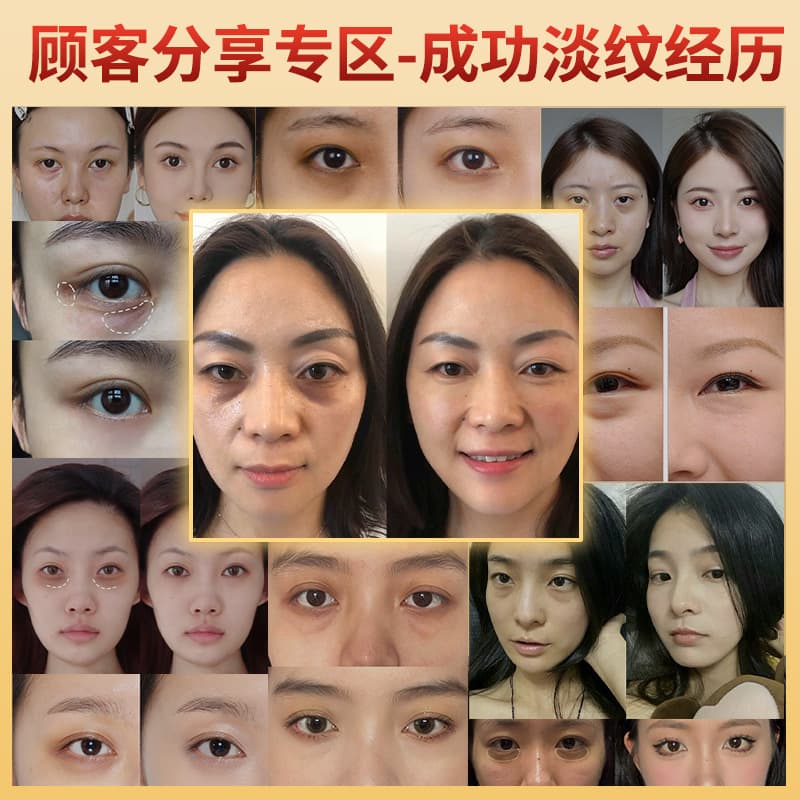 Beauty salon line specializes in Bosein eye cream anti-wrinkle lightening dark circles eye essence skin care product set big brand replacement 4