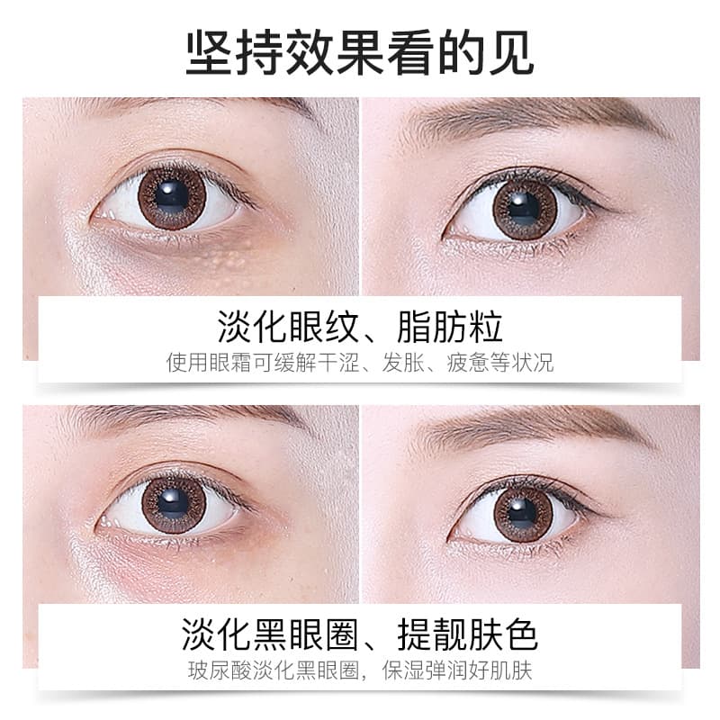DR Snow Polypeptide Essence Wrinkle Smoothing Eye Cream Diminishes Wrinkles, Firms Eye Bags and Dark Circles Polypeptide Anti-Wrinkle Eye Cream 5