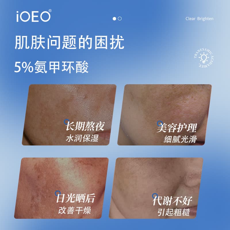 iOEO tranexamic acid 5% essence (tranexamic acid) original solution improves dry, moist and delicate skin care products 3