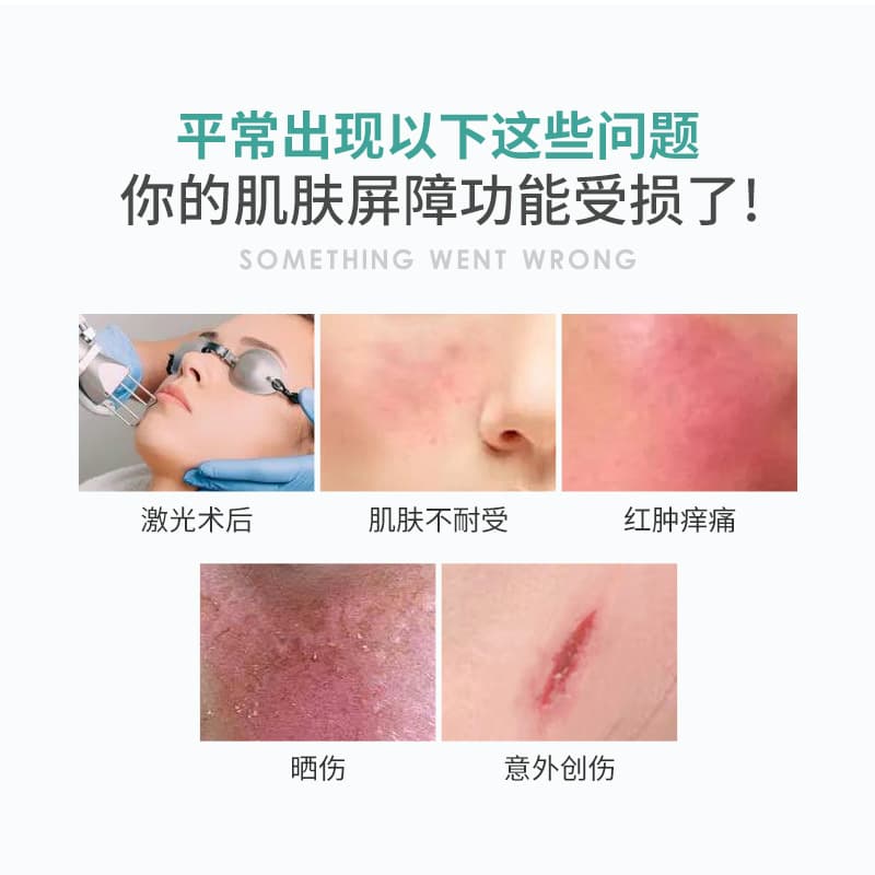 Beauty salon line red blood soothing centella asiatica essence polyoligopeptide sensitive skin repair and recovery liquid processing and customization 3