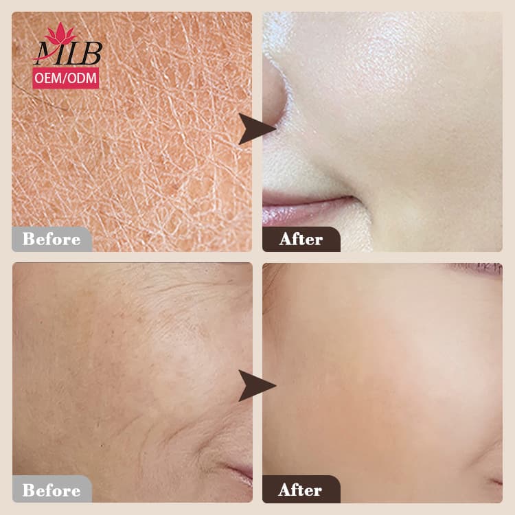 Cross-border customized snail mucus moisturizing and soothing essence soft skin facial essence OEM OEM processing and customization 5