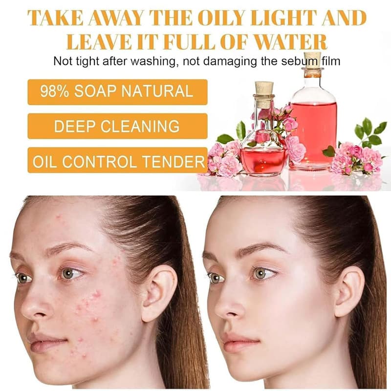 Cross-border foreign trade turmeric turmeric soap mousse cleanser deep cleansing exfoliation lightening acne mark soap 5