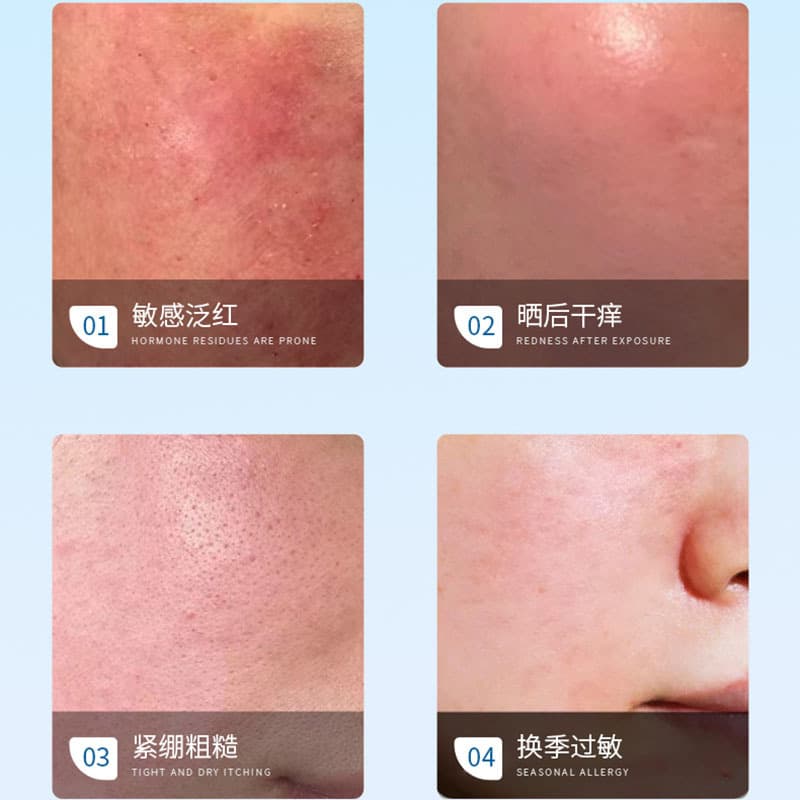 Beauty salon-specific skin care product set, barrier repair, soothing, sensitivity, moisturizing and high-end facial care 3