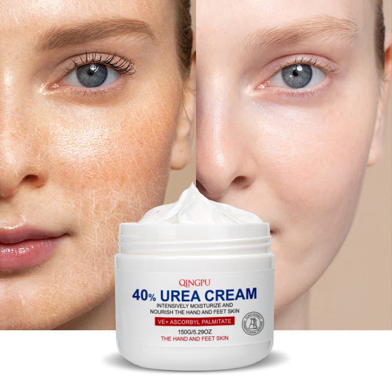 Cross-border 40% urea cream hydrating vitamin e moisturizing cream moisturizing body lotion facial care body care face cream wholesale 4