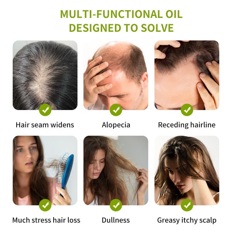 Cross-border anti-hair loss essential oil, long-lasting hair care essence oil, long-lasting fragrance, nourishes the scalp, prevents frizzy hair 4