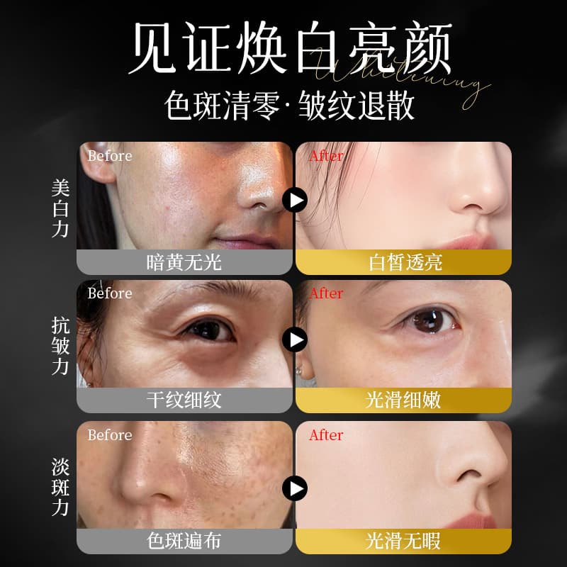 377*577 Whitening, freckle removal, anti-wrinkle cream, anti-aging, firming, autumn and winter moisturizing and nourishing black bandage cream 5