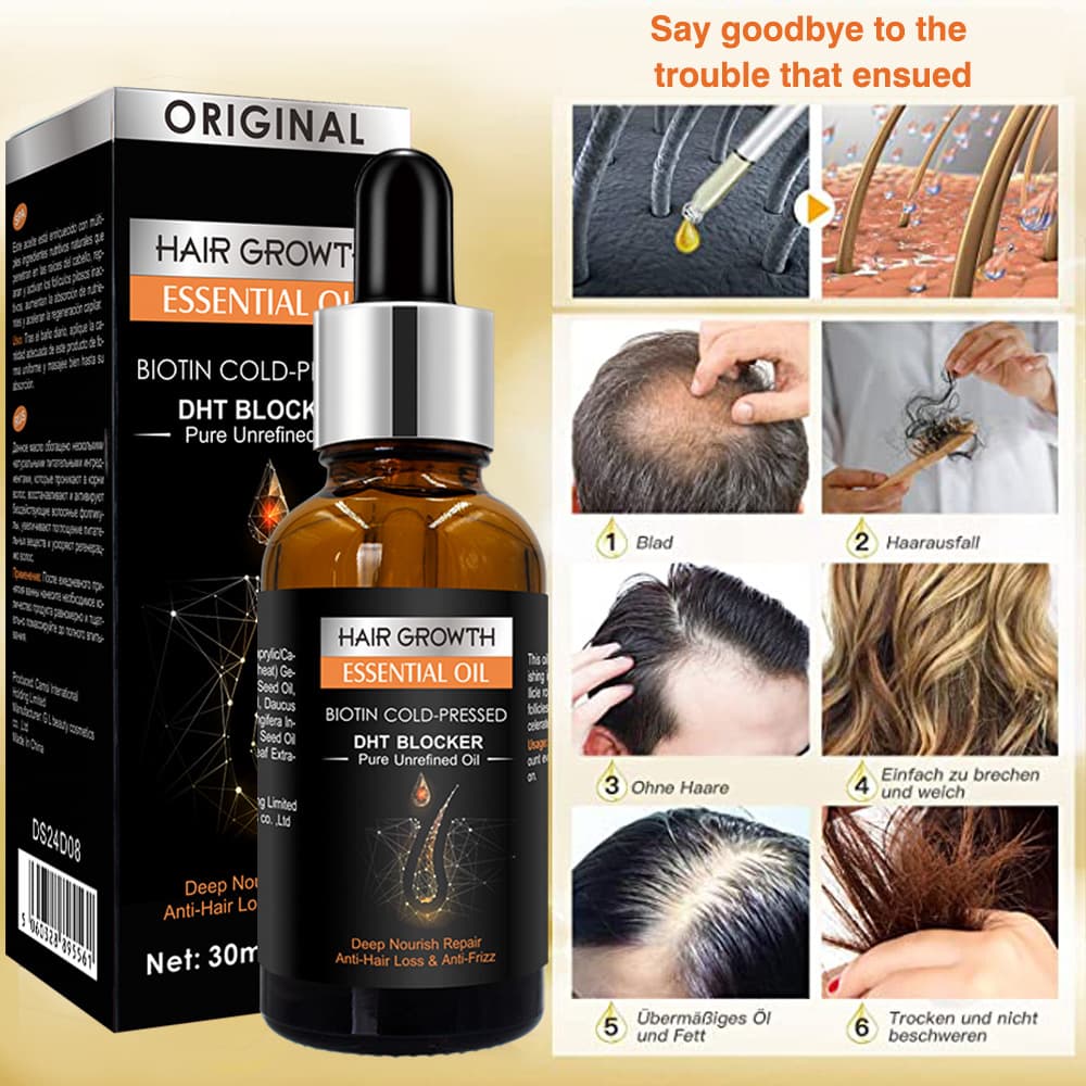 (Cross-border trading), (Wholesale), medical hair oil with ginger for scalp, non-washable massager, self-care, for hair care 2