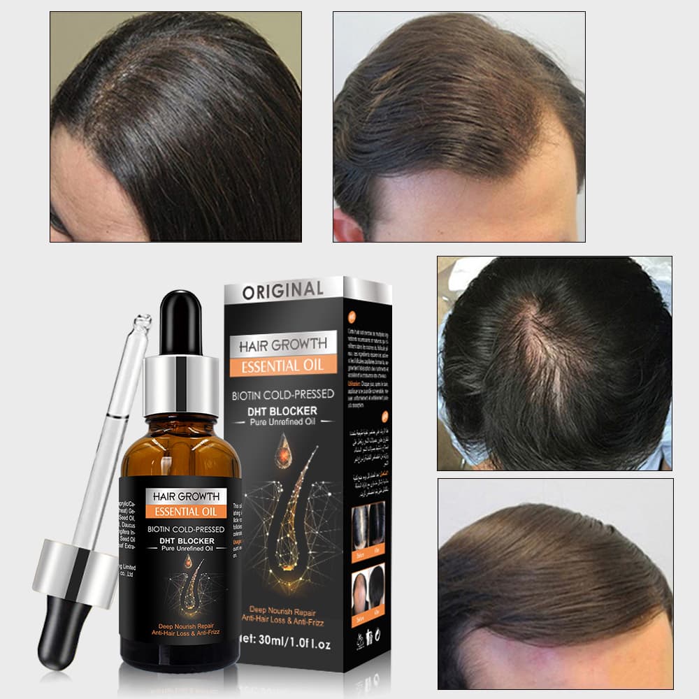 (Cross-border trading), medical hair oil with ginger for scalp, non-washable massager, self-care, for hair care