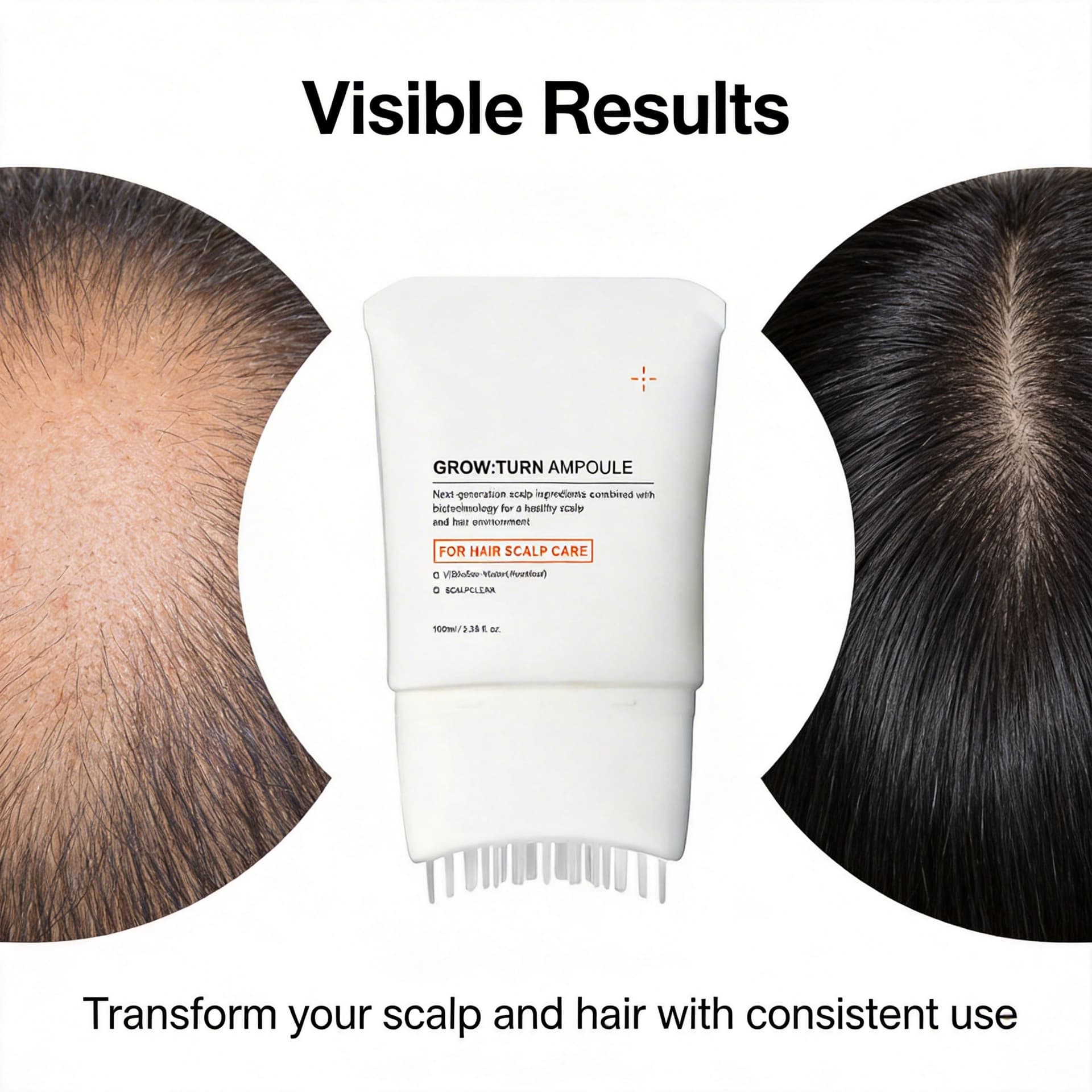 Hair Growth Serum hair growth essence comes with a brush for massaging and thickening hair beauty 4