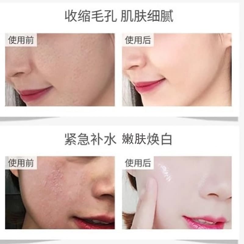 Herbal cosmetic brightening face mask, revitalizing acne remover from black spots, film mask, easy application, for beauty salons, skin tone brightening, conceals acne 4