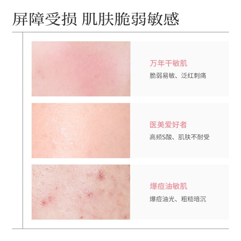 (Wholesale), white oil, moisturizing essence, face serum for skin care, essential oil 2