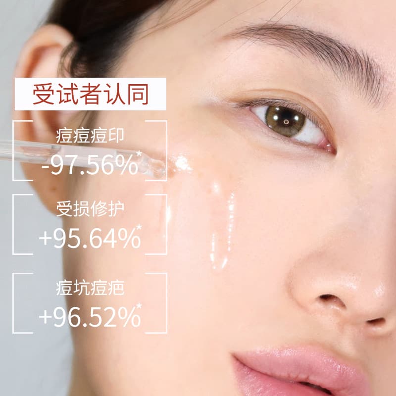 Revitalizing Oligopeptide Face Serum - Brightening Moisturizer, Acne & Pore Minimizer 4