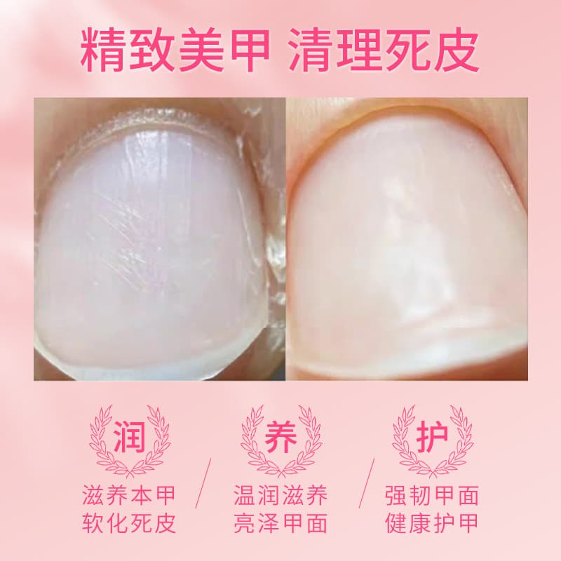 Finger oil for nails, nourishing oil for manicure, gel polish, medical revitalizing lotion 4