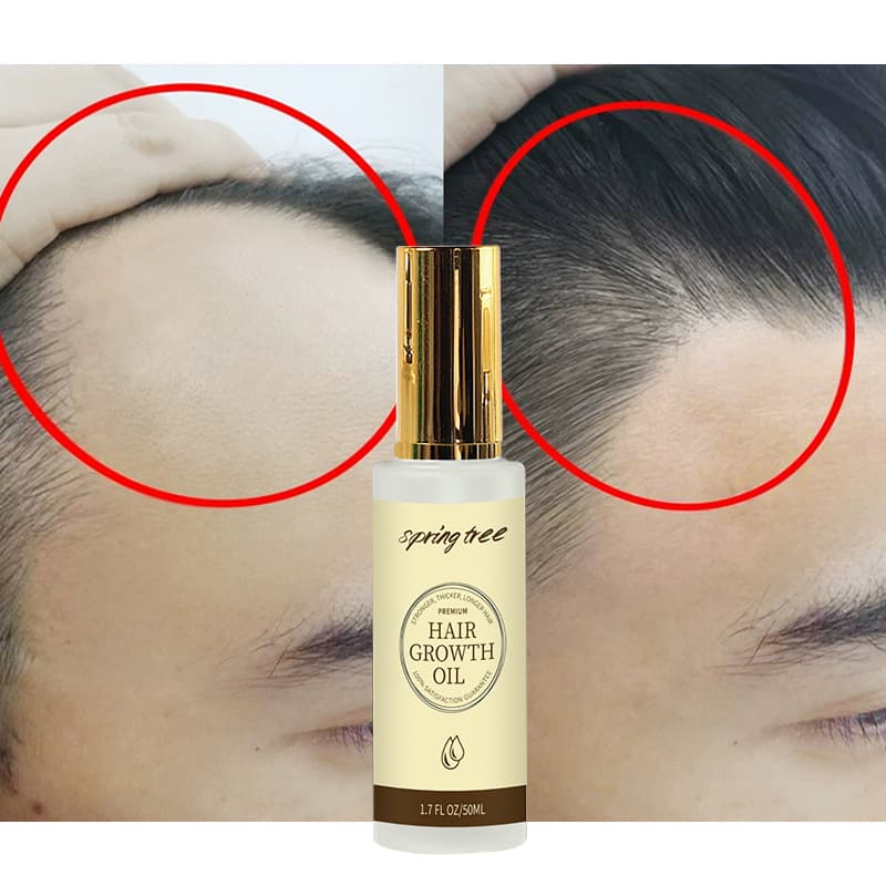 Essential Oils for Hair Growth - Anti-Frizz Formula 2