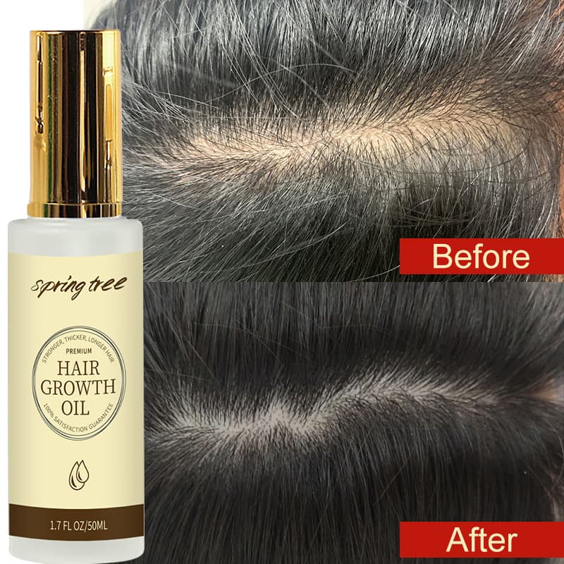 Essential Oils for Hair Growth - Anti-Frizz Formula 1