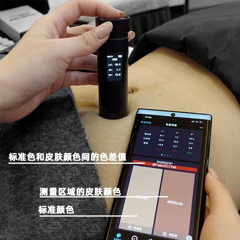 Lottery Skin Seasonal Pattern Repairing stretch marks Covering obesity patterns to repair skin color measuring device skin chromators 5