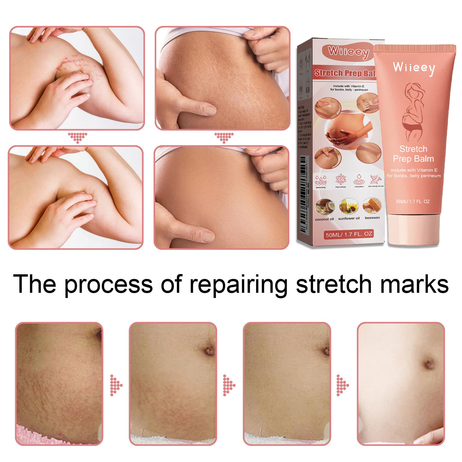 wiieey Postpartum brightening cream, smoothing medical massager, anti-wrinkle 3