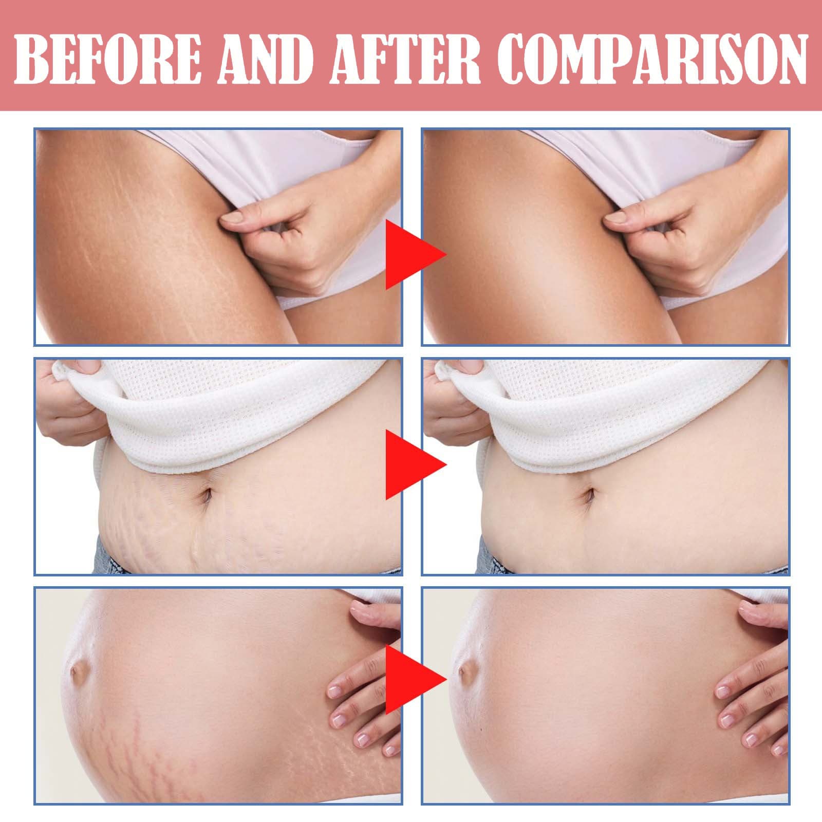 wiieey Postpartum brightening cream, smoothing medical massager, anti-wrinkle 4
