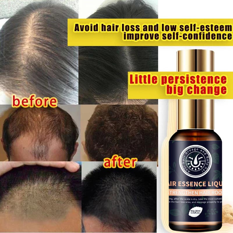 Hair Growth Fast Oil - Polygonum Extract 2