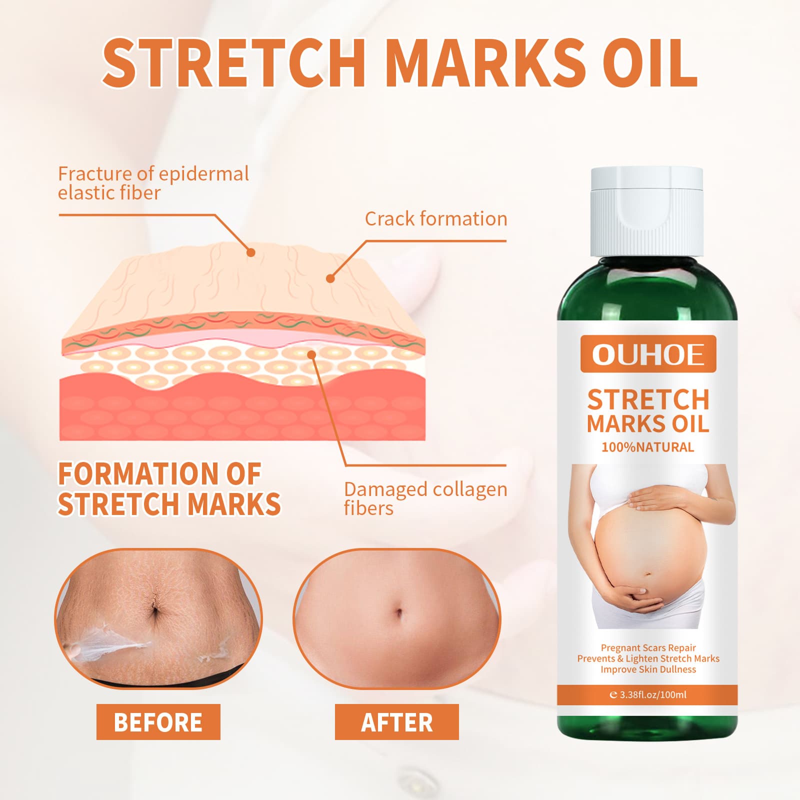 OUHOE Revitalizing postpartum smoothing medical massage oil 4