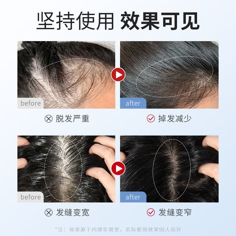 Nutritious medical serum for scalp, healthy hair, for hair care, (Physicals) 5