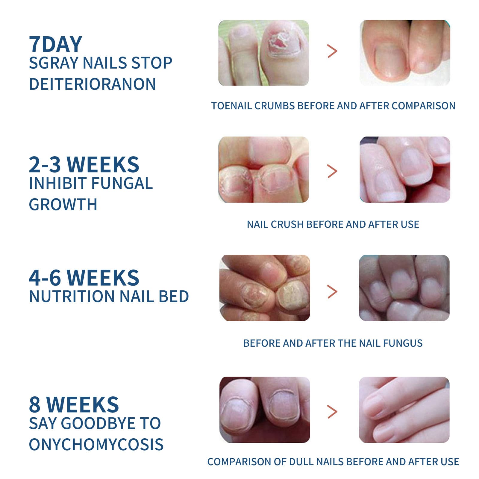 EELHOE Toenail Care Patch Mild ingredients care for the nail surface, smooth and shiny, breathable and skin-friendly care patch 3