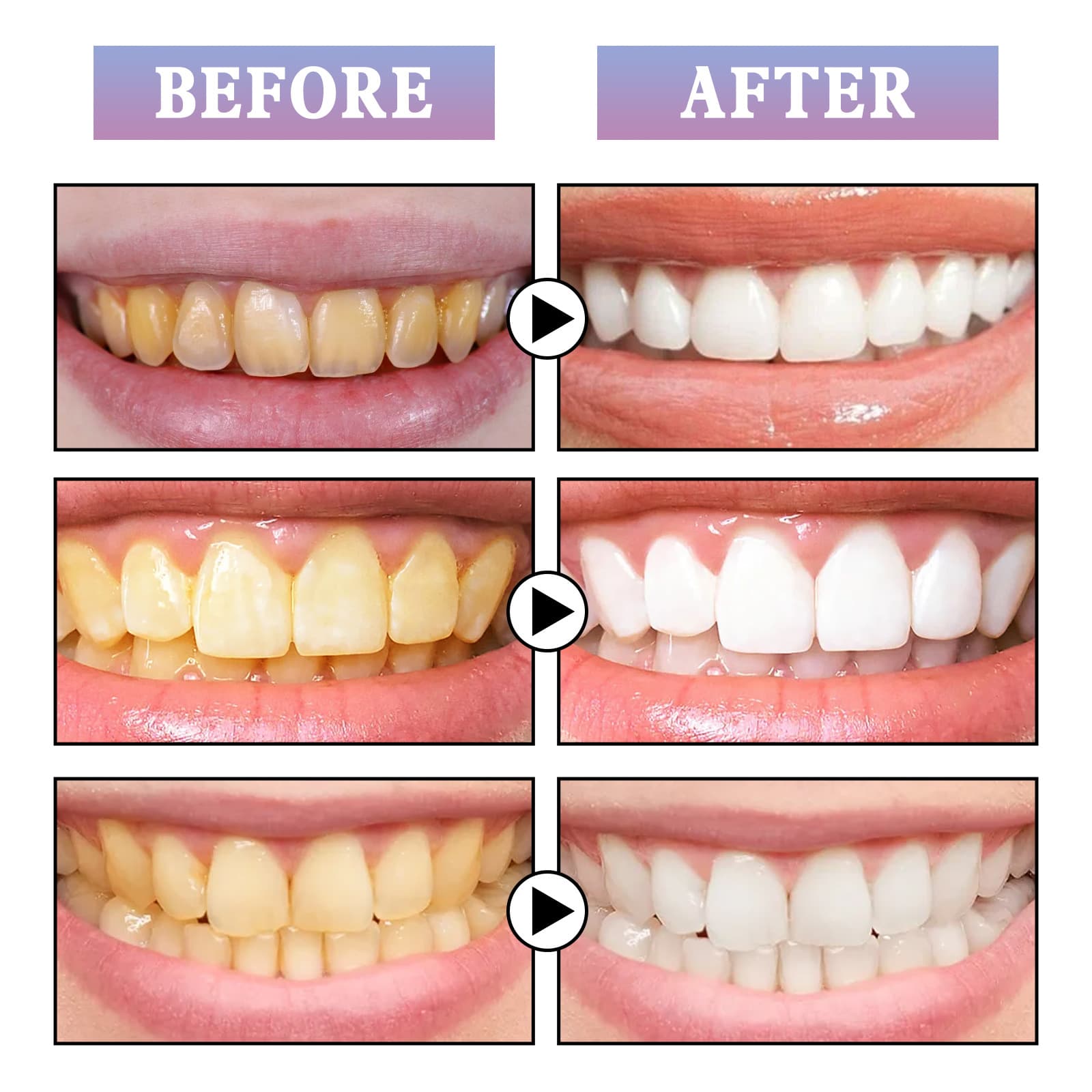 Eelhoe, fresh toothbrush for oral cavity 4