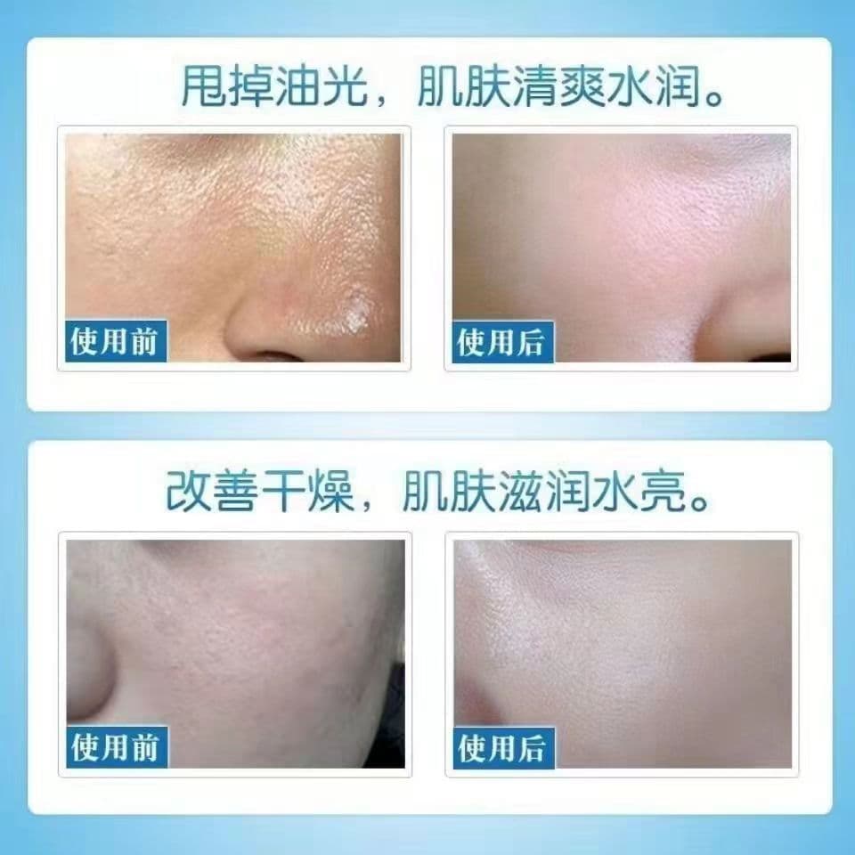 (Wholesale), moisturizing brightening essence with hyaluronic acid, urea-based, skin tone brightening, shrinks pores, intense hydration 4
