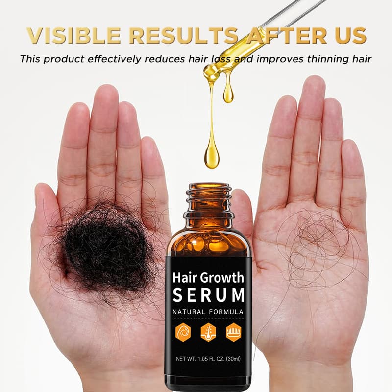 Cross -border spot growth hair root nutrition solution hair geowth serum to promote growth and anti -hair essential oil 4
