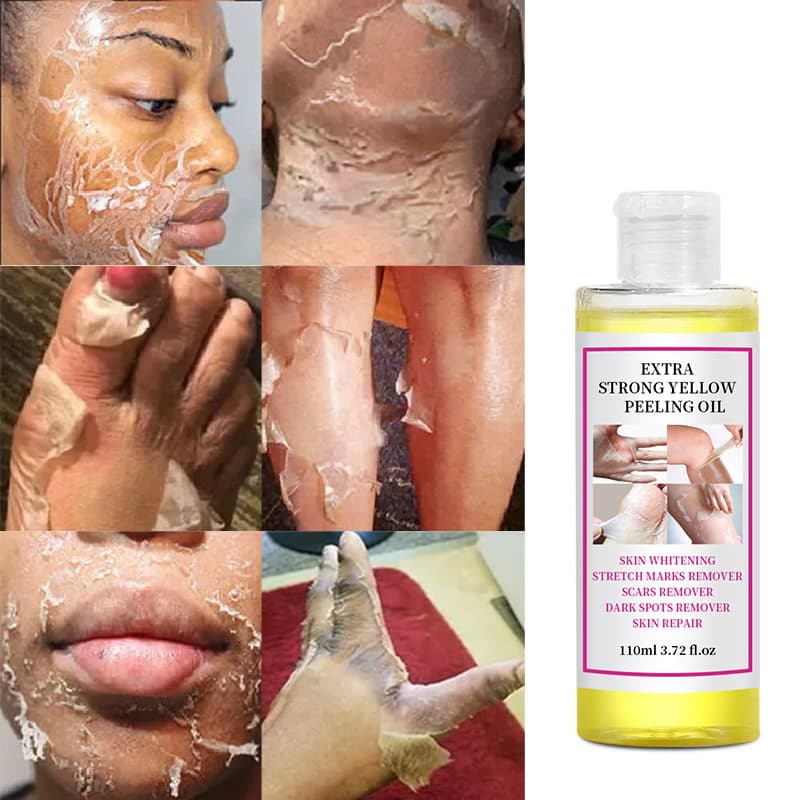 (Cross-border trading), exfoliating whitening essential oil for hands for face full body, peeling 4