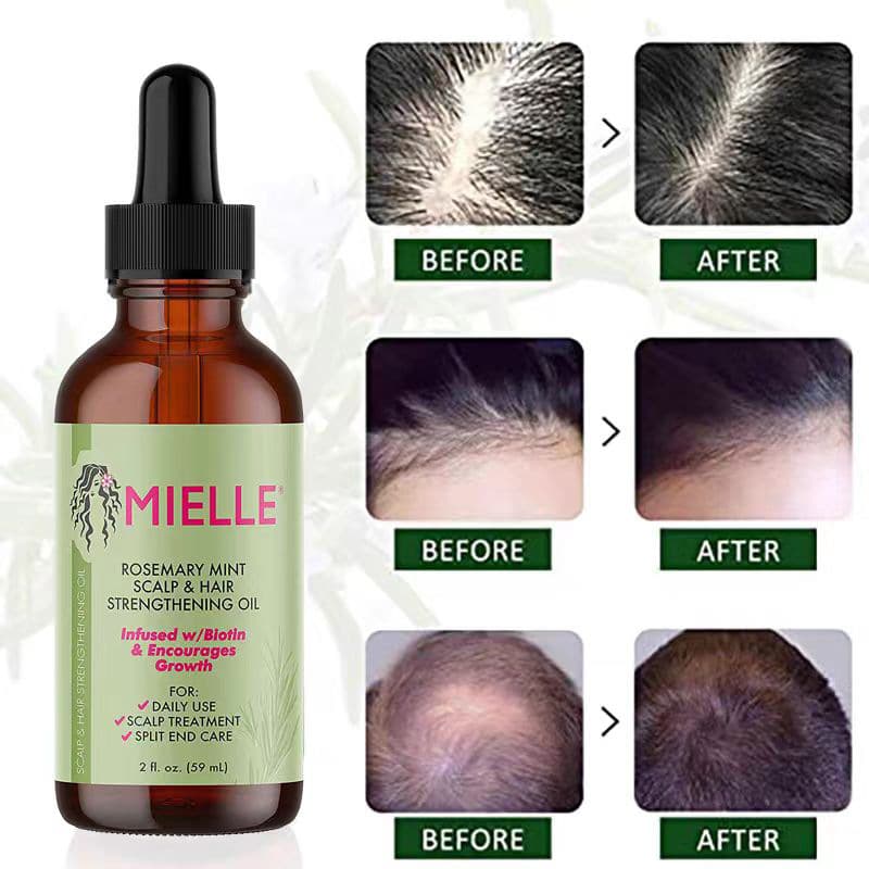(Cross-border trading), oil, nutritious perfume with rosemary, 59 ml, for hair care 1