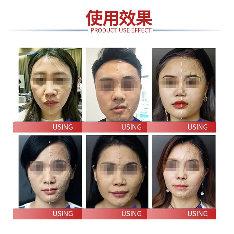(Wholesale), pulls up face mask, cosmetic set, anti-wrinkle, for beauty salons, easy application 2