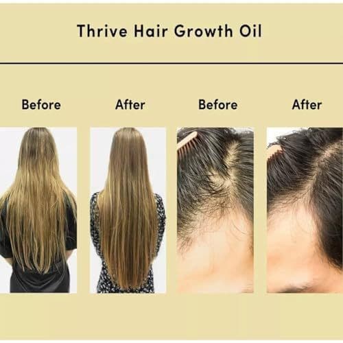 (Cross-border trading), medical massager for scalp, revitalizing conditioner, hair oil for curly hair 4
