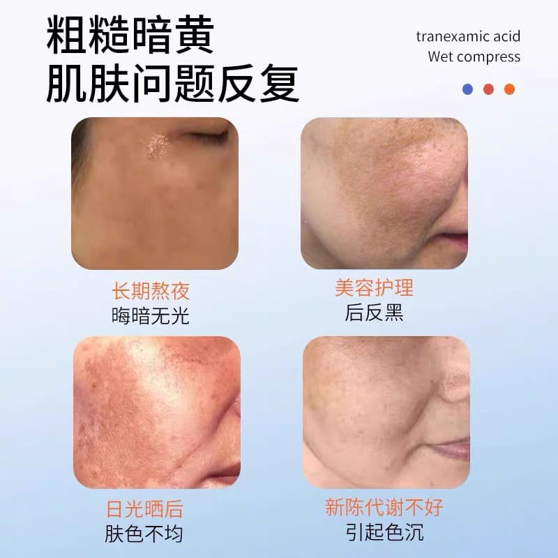 Wet tranexamic acid, revitalizing capacious essence 4