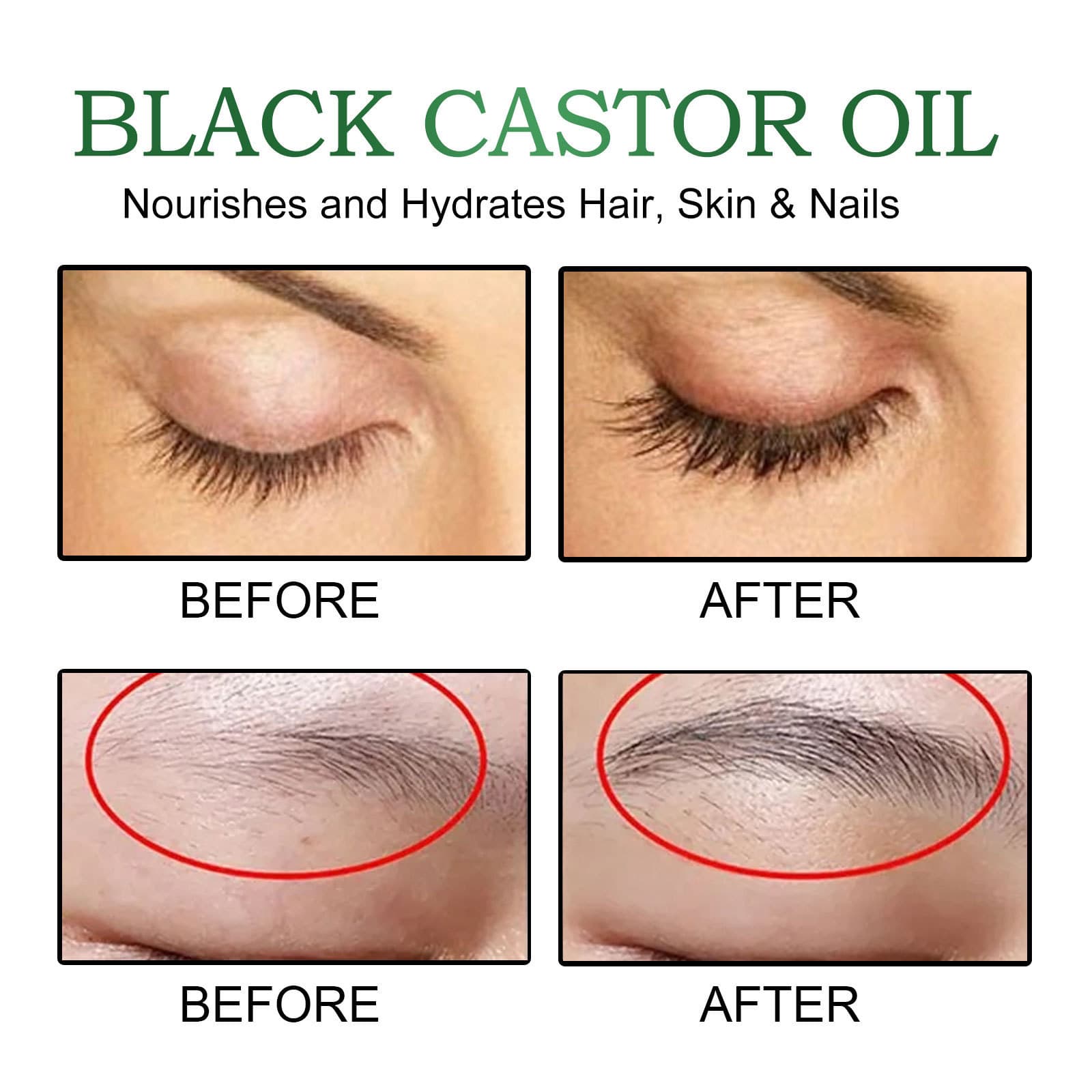 EELHOE Castor Oil Hair Thickening Liquid 4