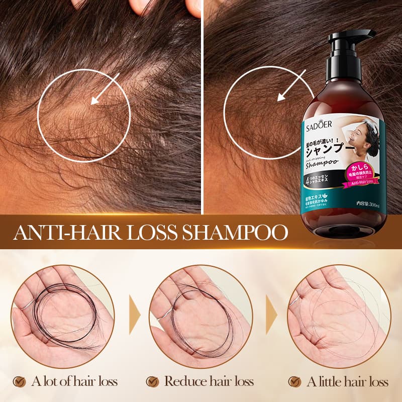 (Cross-border trading), (Wholesale), shampoo, English, dandruff removal 4