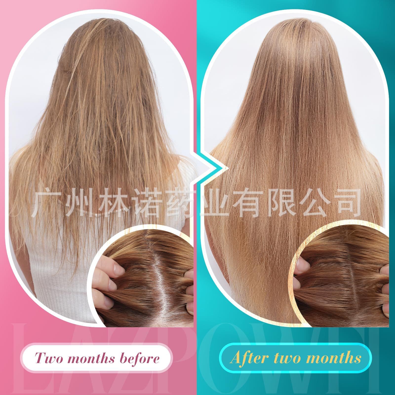 [Hair Growth gummies with 5000mcg Biotin for Women&Men,60Ct] 3