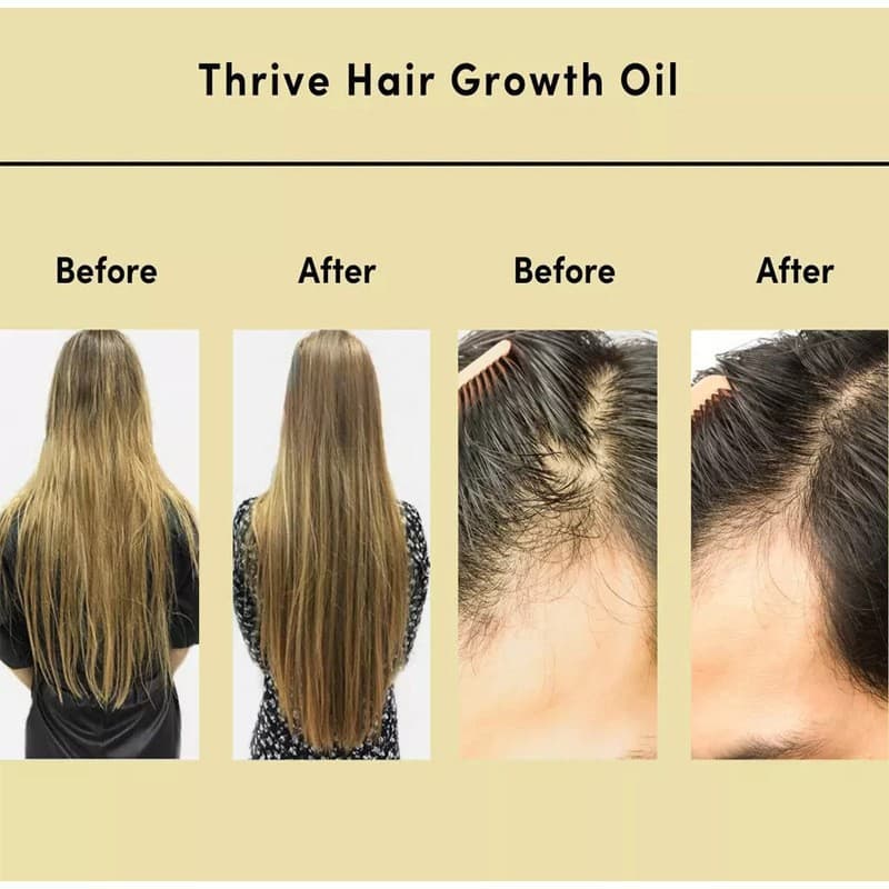 Rosemary Hair Growth & Repair Oil - THRIVE GROWTH 4