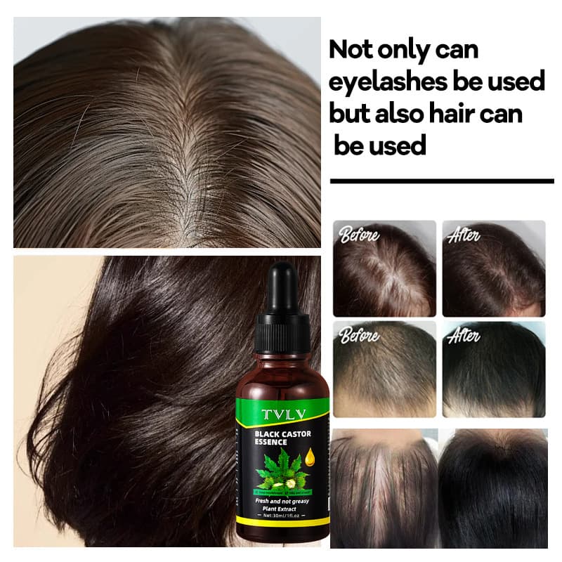 [跨境TVLV黑蓖麻精华液头发护理睫毛护发精油Hair care essential] 3