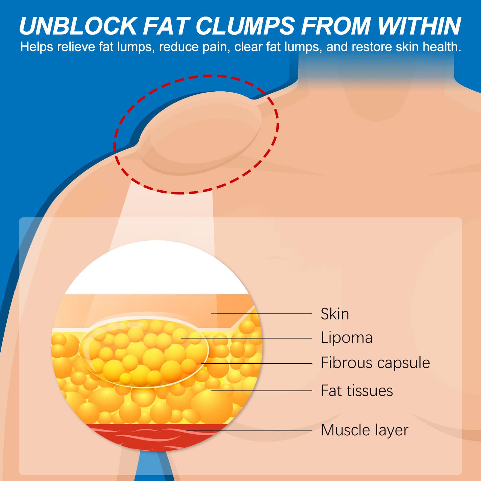 South Moon Fat knot care series relieves body swelling and multi -fat knot hard block body care 3