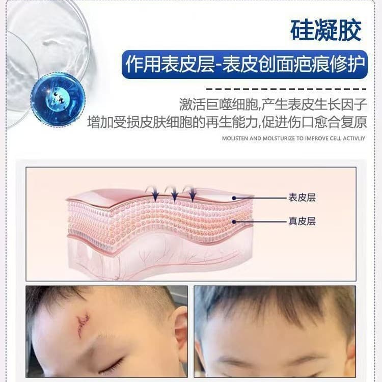 Medical Scar Removal Sticker - Burns & Surgery Scars 4