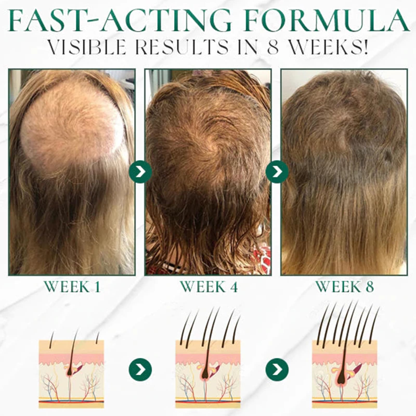 No Bald Hair Growth Oil Blend, No Bald Growth Oil Blend Promotes Hair Growth 4
