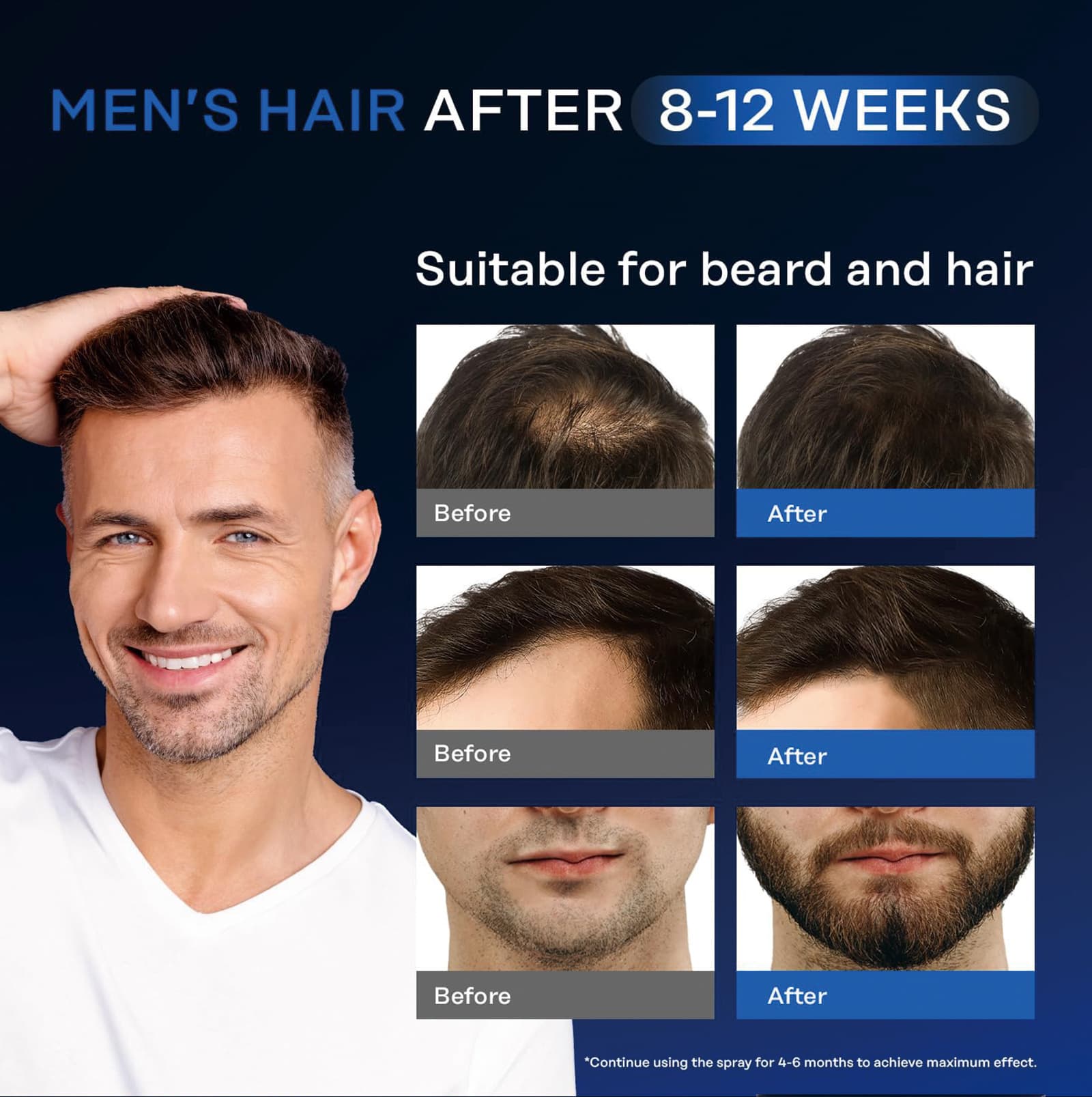 Cross-border Minoxidil Hair Growth Serum Anti-hair Loss Hair Growth Agent Hair Care Hair Growth Serum 4