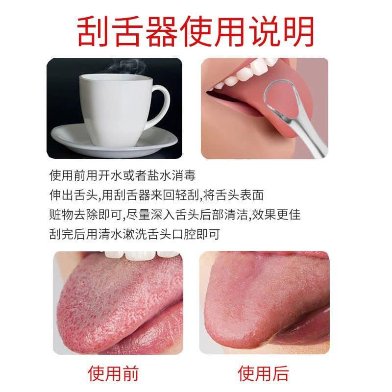 Spot U-shaped cleaning oral tools tongue coating cleaner stainless steel tongue scraper tongue coating brush cleaner 3