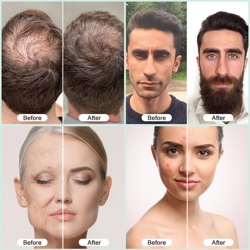Hair Growth Serum with PDRN - Tightening & Firming 3