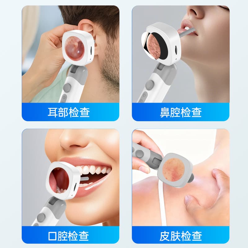 Endoscope Cross-border Otoscope Ear Camera High Definition Visual Otoscope Ear Speculum ENT Inspection Mirror 4