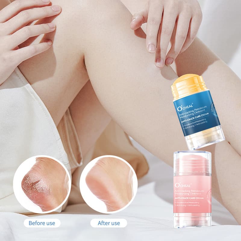 (Cross-border trading), nutritious medical moisturizing protecting hand cream full body, foot cream, against cracks, crack prevention 2