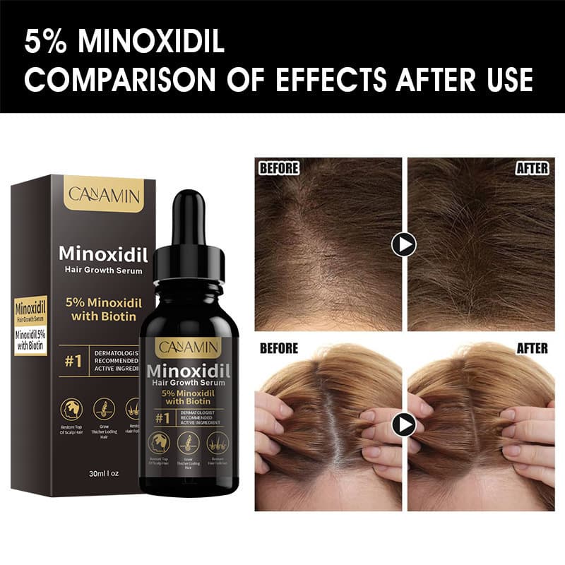 MSDS Milo Essence Oil HAIR ROWTH SERUM nourishes, improves density and thickens men's cross-border 3